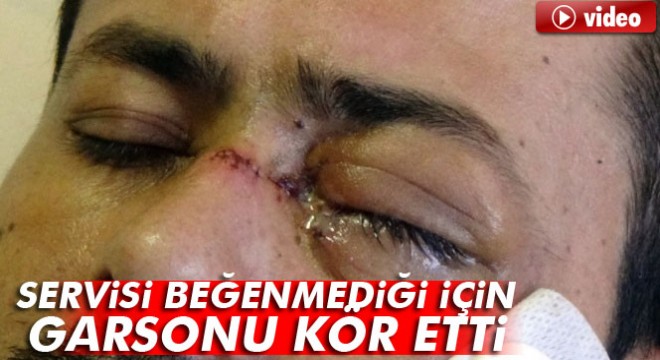 Adıyaman'da servisi beğenmediği için garsonu kör etti