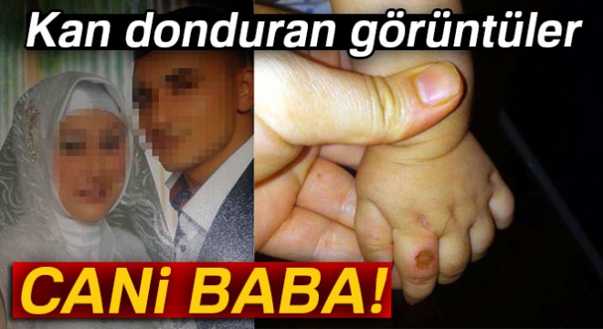 Babanın çocuğunun üzerinde sigara söndürdüğü iddiası