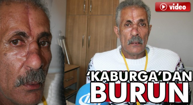 Burnu kırılmıştı; Yemen'in kokusunu Türkiye'de aldı