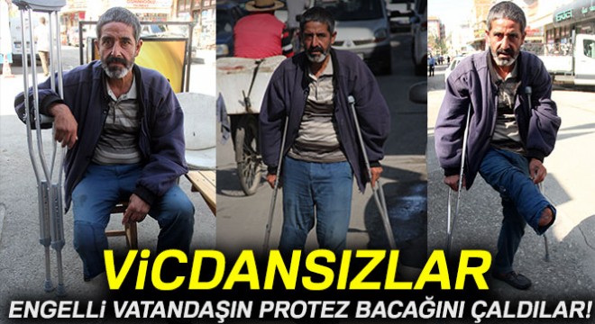 Engelli vatandaşın protez bacağını çaldılar