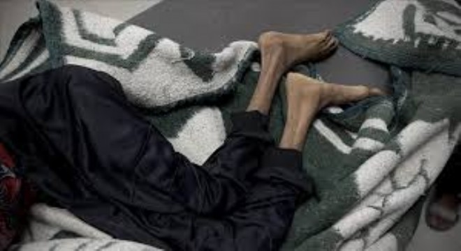 Gazze'de Ağustos Ayında 185 Kişi Açlıktan Öldü