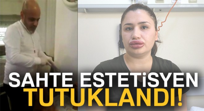 Sahte estetik uzmanı kuaför, hırsızlık suçundan tutuklandı