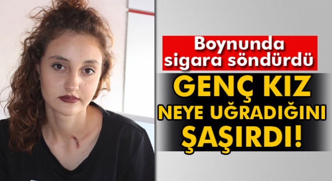 Sokakta genç kıza sigaralı saldırı