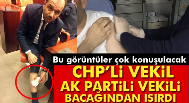 TBMM'de CHP Milletvekili, AK Partili Balta'yı bacağından ısırdı