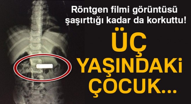 Trabzon'da 3 yaşındaki çocuk televizyon kumandasının pilini yuttu